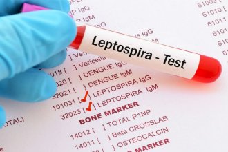 Otro entrerriano falleció por leptospirosis e investigan cómo contrajo el virus