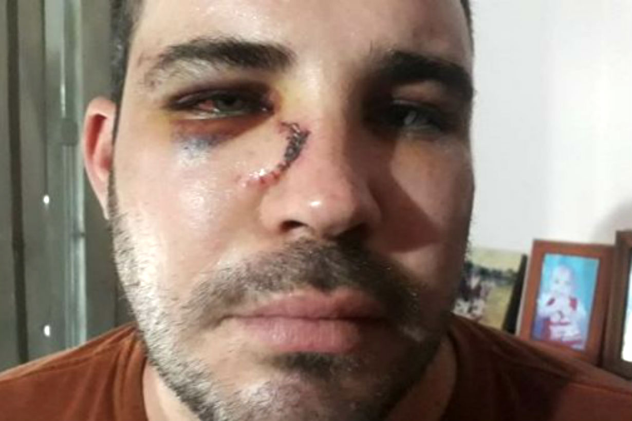 Ríos dice que fue golpeado por policías.