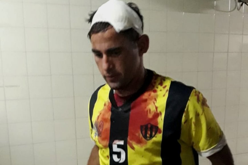 Federico Batista, uno de los jugadores heridos