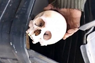 Vecinos fueron a arrojar sus residuos y encontraron en el contenedor un cráneo humano