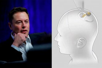 Elon Musk anunció que en 6 meses se implantará el primer chip en un cerebro humano