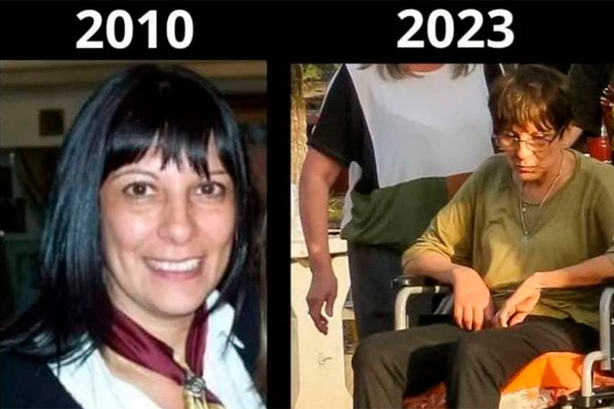 Graciela, antes y ahora