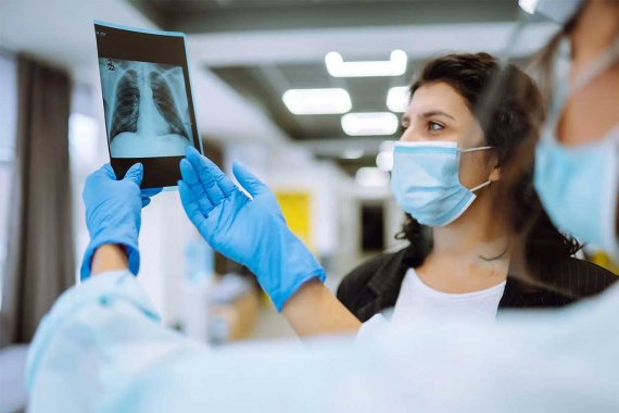 Alerta sanitaria: los casos de tuberculosis en Entre Ríos aumentaron casi un 39% en lo que va de 2026