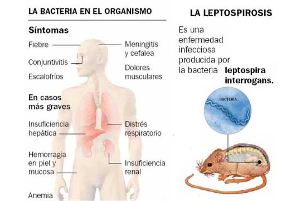 Entre Ríos registra 15 casos de leptospirosis en lo que va del año - Noticias - Elentrerios.com