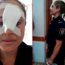 Mujer con historial de violencia fue detenida tras agredir a la jefa de una comisaría