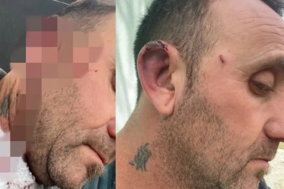 Habló el intendente entrerriano agredido por un concejal: &ldquo;No valía la pena&rdquo;