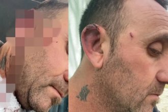 Habló el intendente entrerriano agredido por un concejal: &ldquo;No valía la pena&rdquo;
