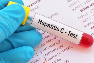 Hepatitis C: testeos rápidos para detectar una enfermedad que puede permanecer &ldquo;silenciosa&rdquo; durante décadas